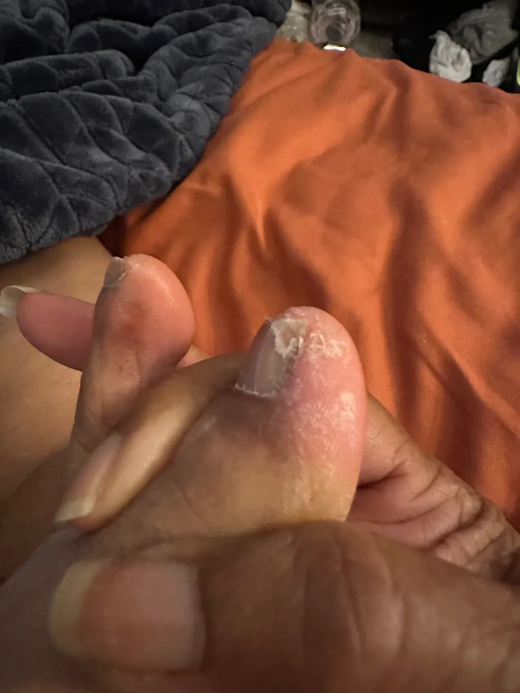 Faded Sole Closeup
