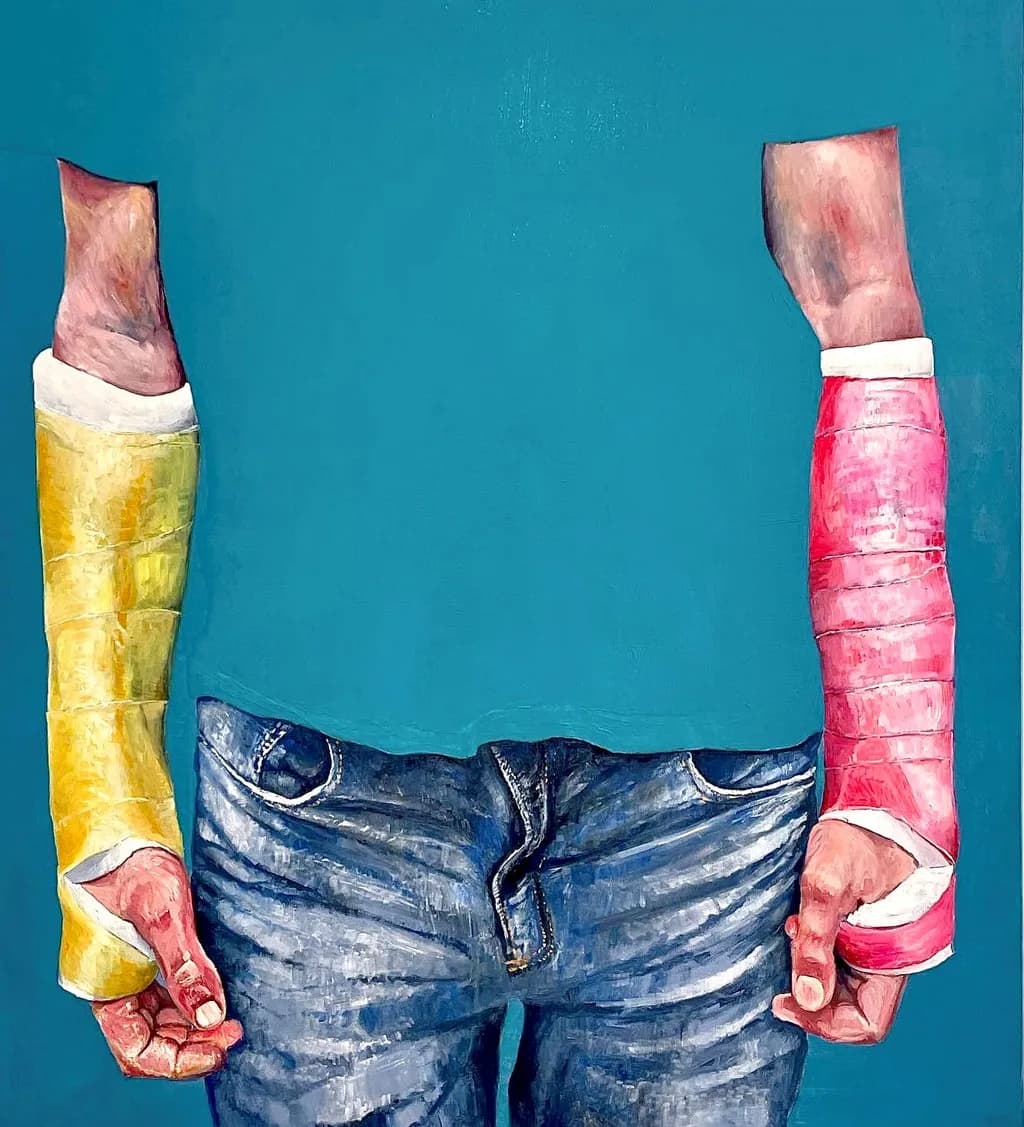 Duality of Resilience: A Study in Color and Strength