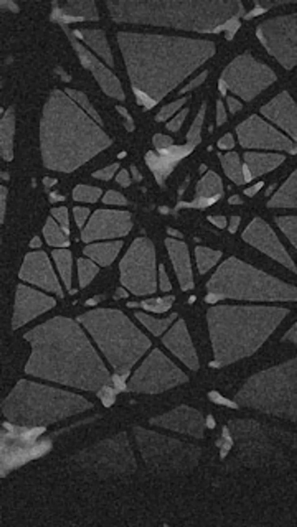 Veins of Shadow