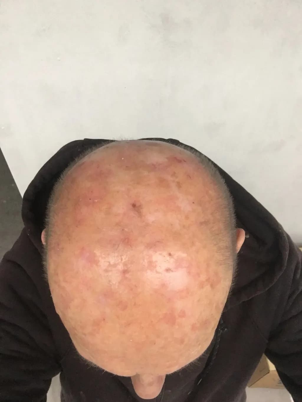 Reflections of Resilience: A Close-Up Study of Skin and Identity
