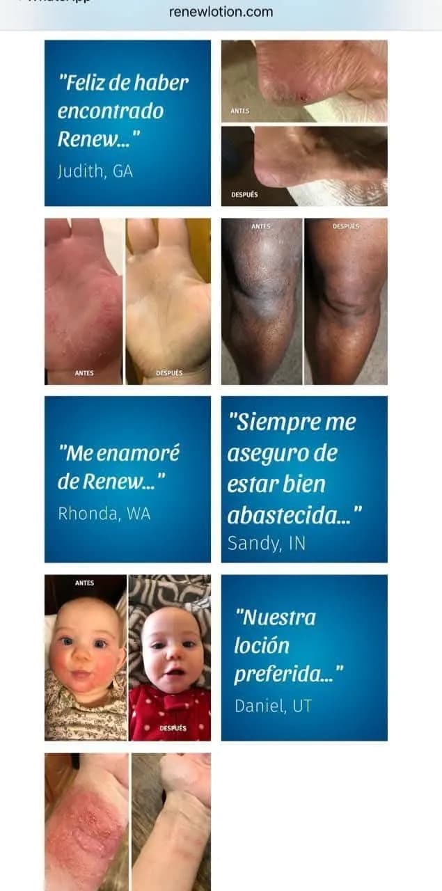 Renew Your Skin: Transformative Before and After Testimonials of Renew Lotion