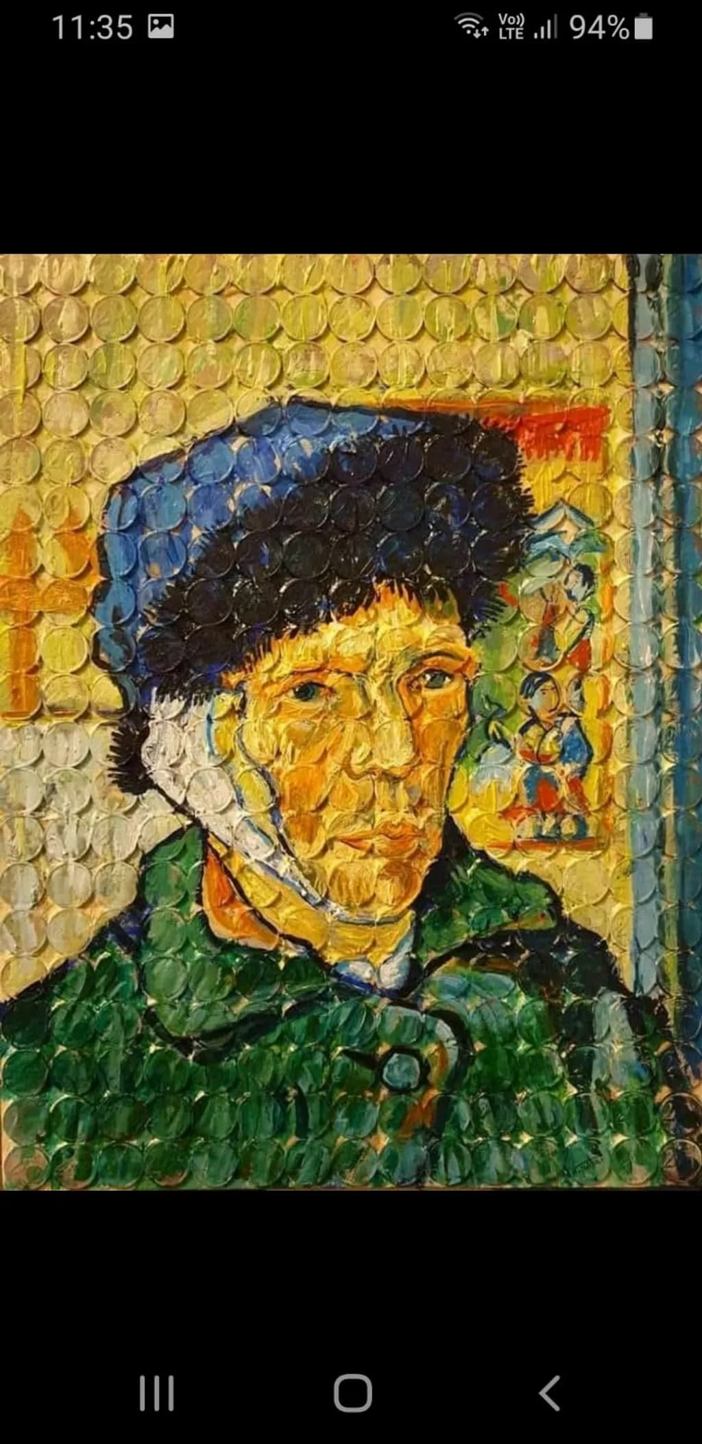 Vincent with Bandage