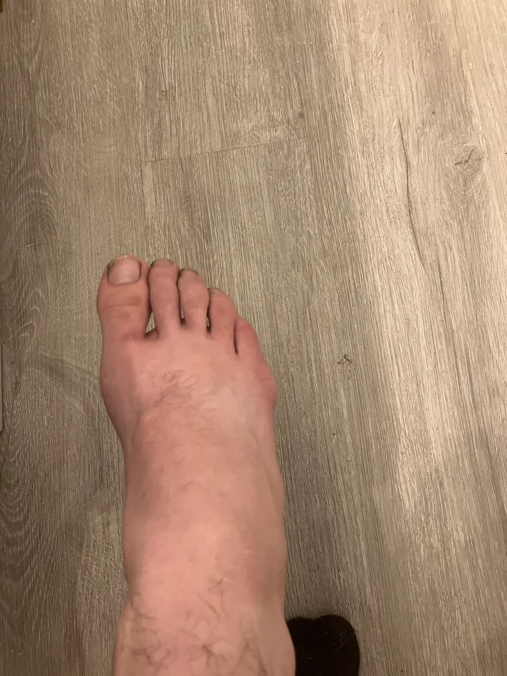 Foot Study