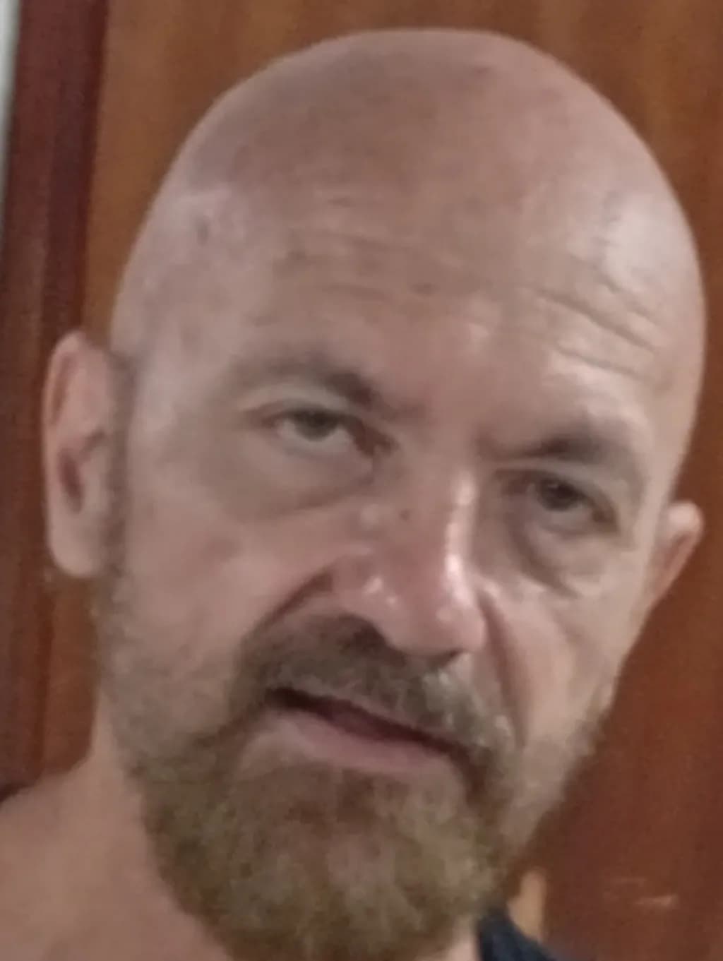 Intense Gaze
