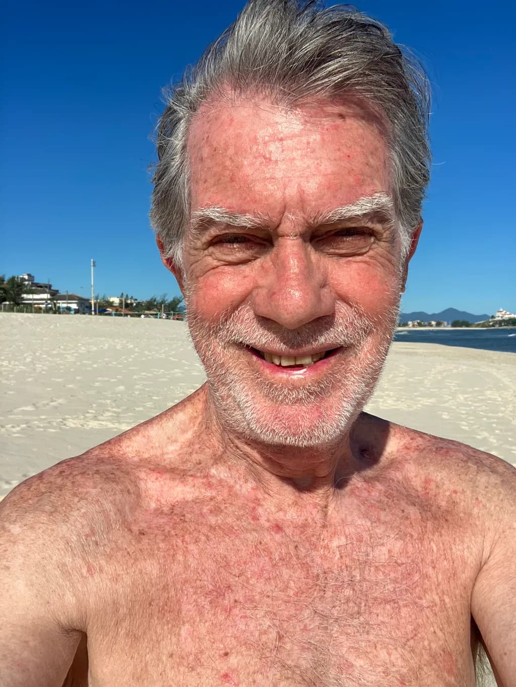 Beachside Smile