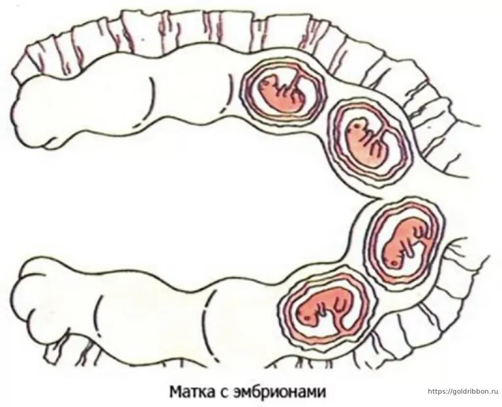 Embryonic Uterus Cross-Section