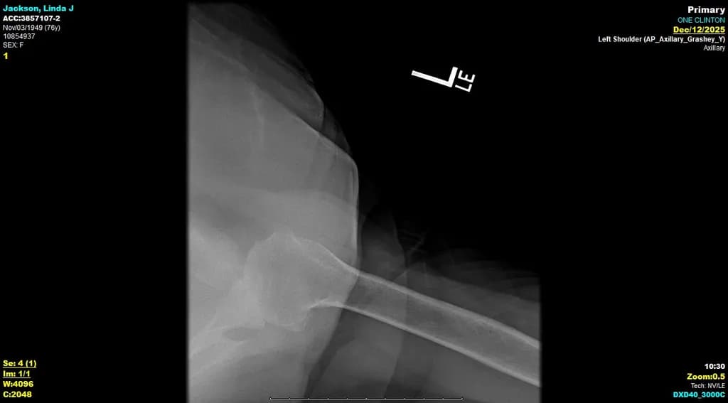 Jackson Linda J X-Ray