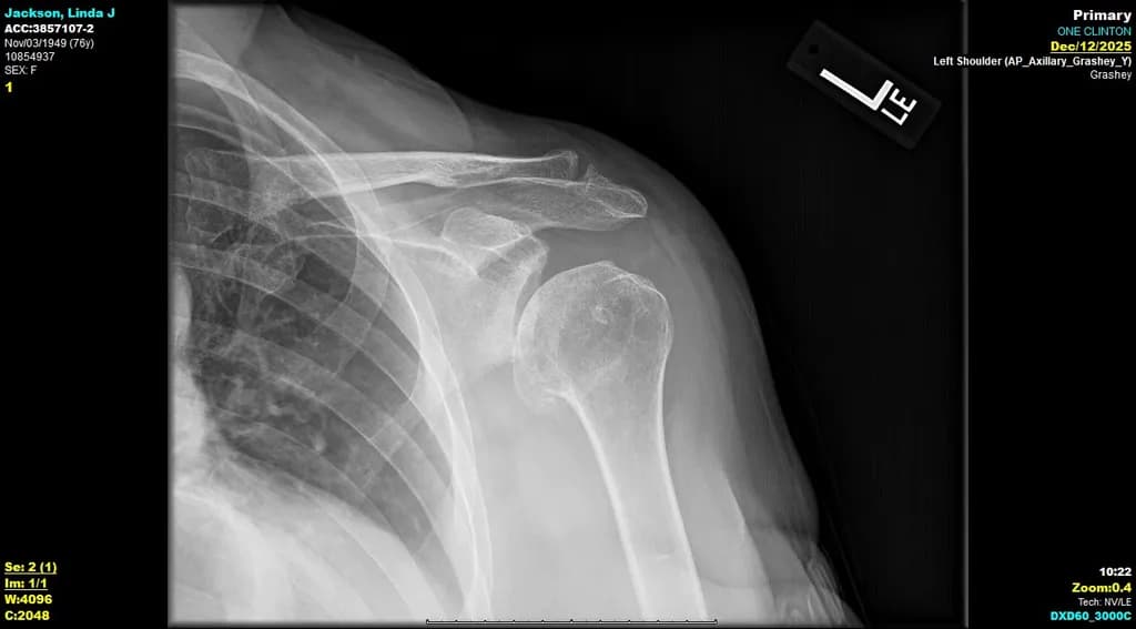 Jackson Linda J Shoulder X-ray