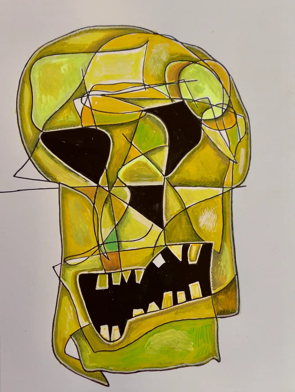Fractured Skull