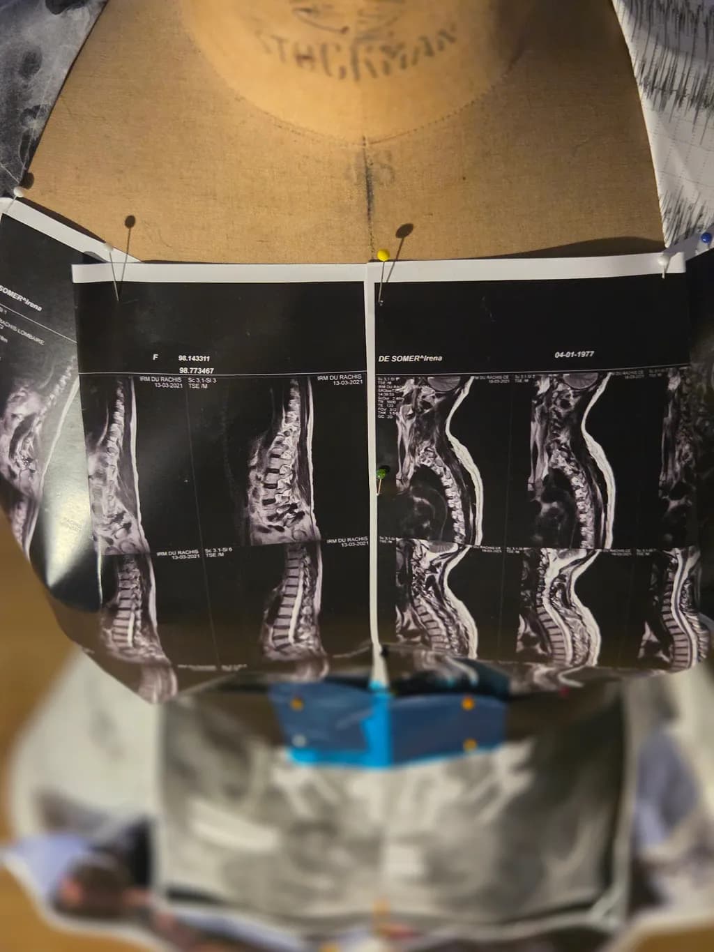 Pinned Radiograph Collage