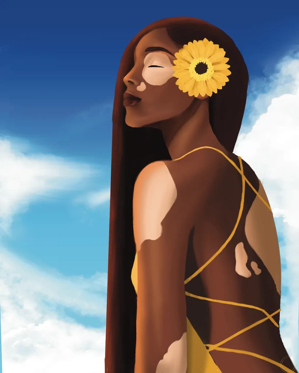Vitiligo Beauty