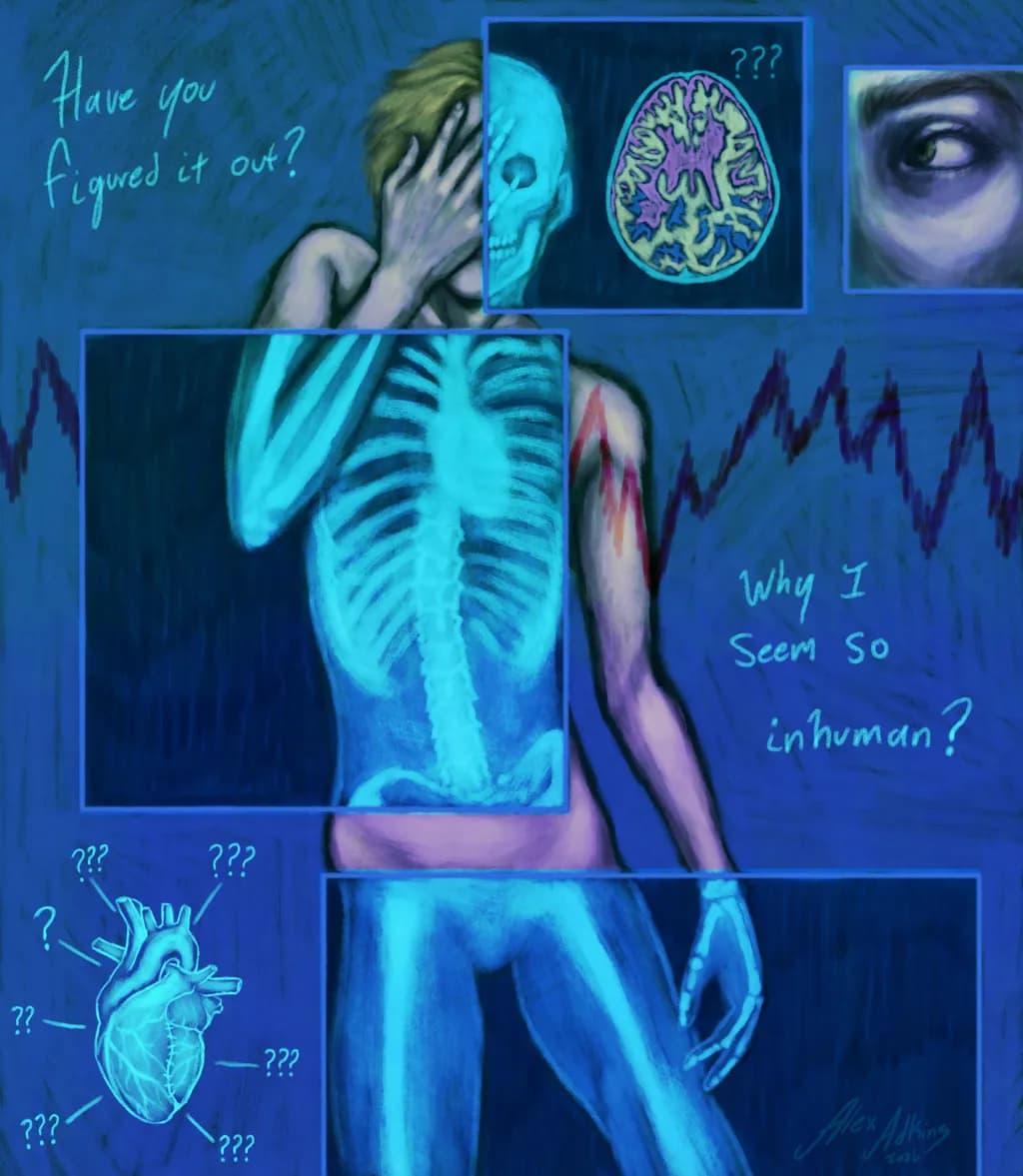 Xrays of Doubt
