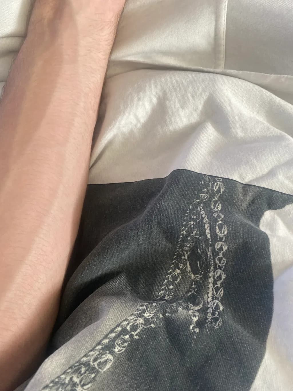 Veined Arm Contrast