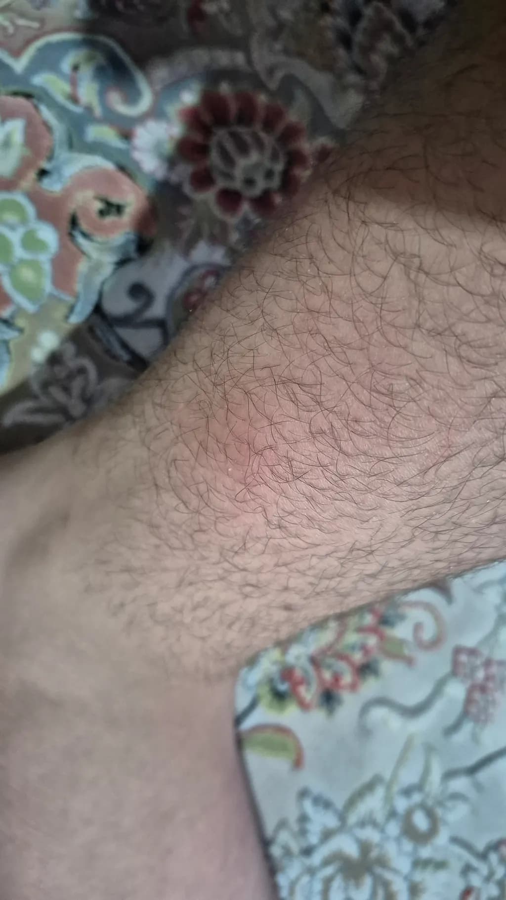 Skin Detail