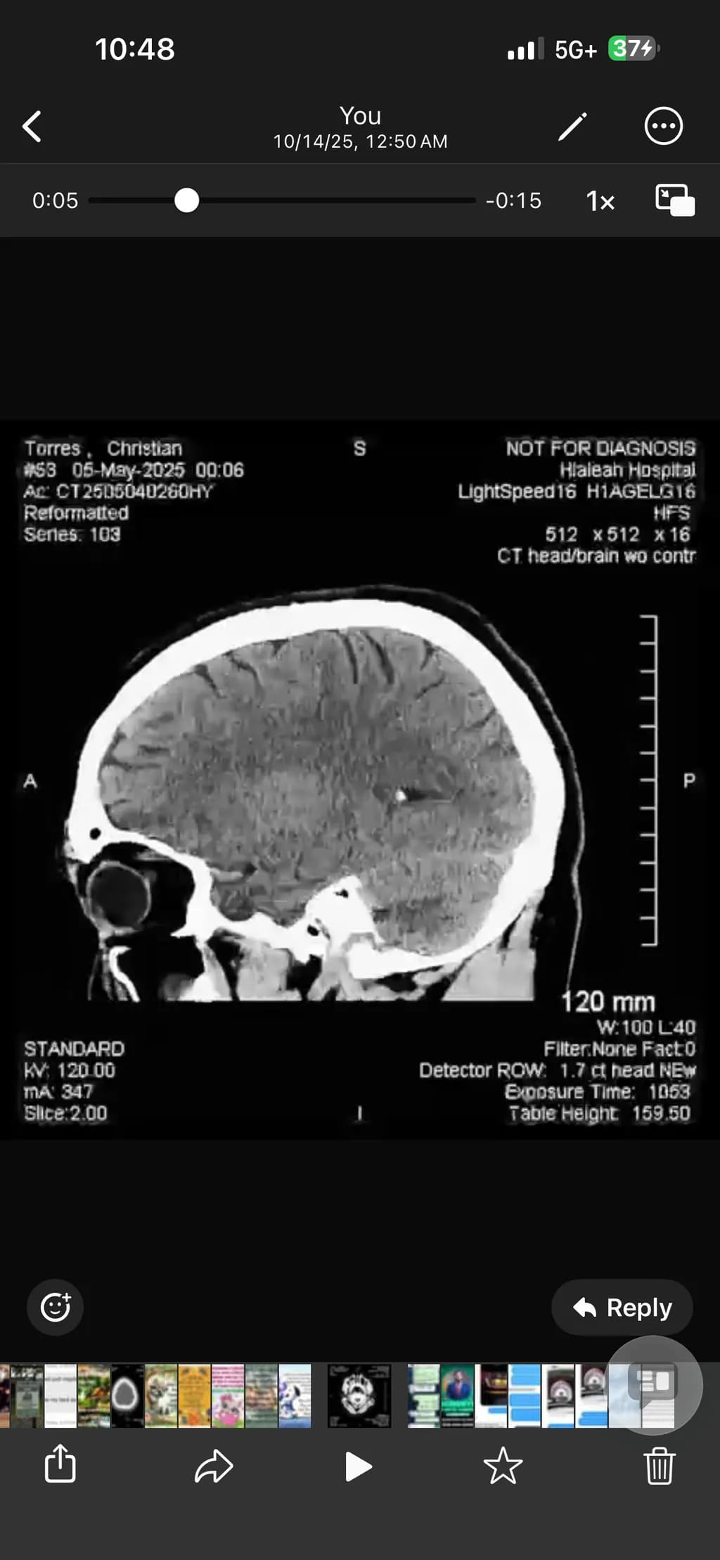 CT Head Scan