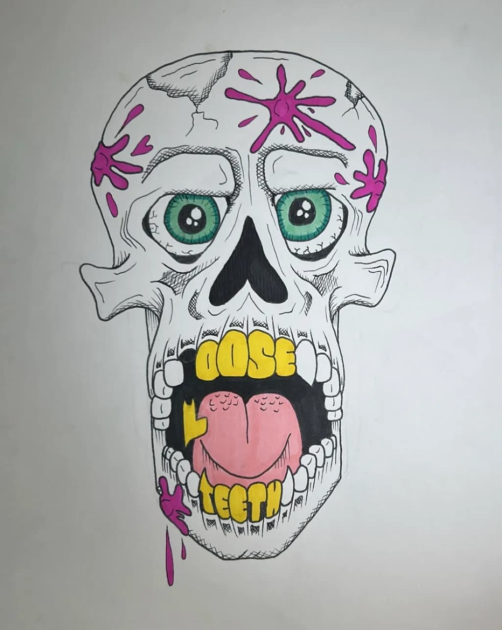 Skull Loose Teeth