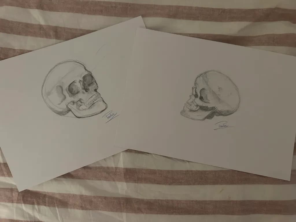 Study of Two Skulls