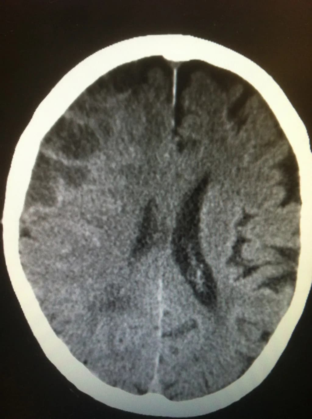 Cerebral Contours