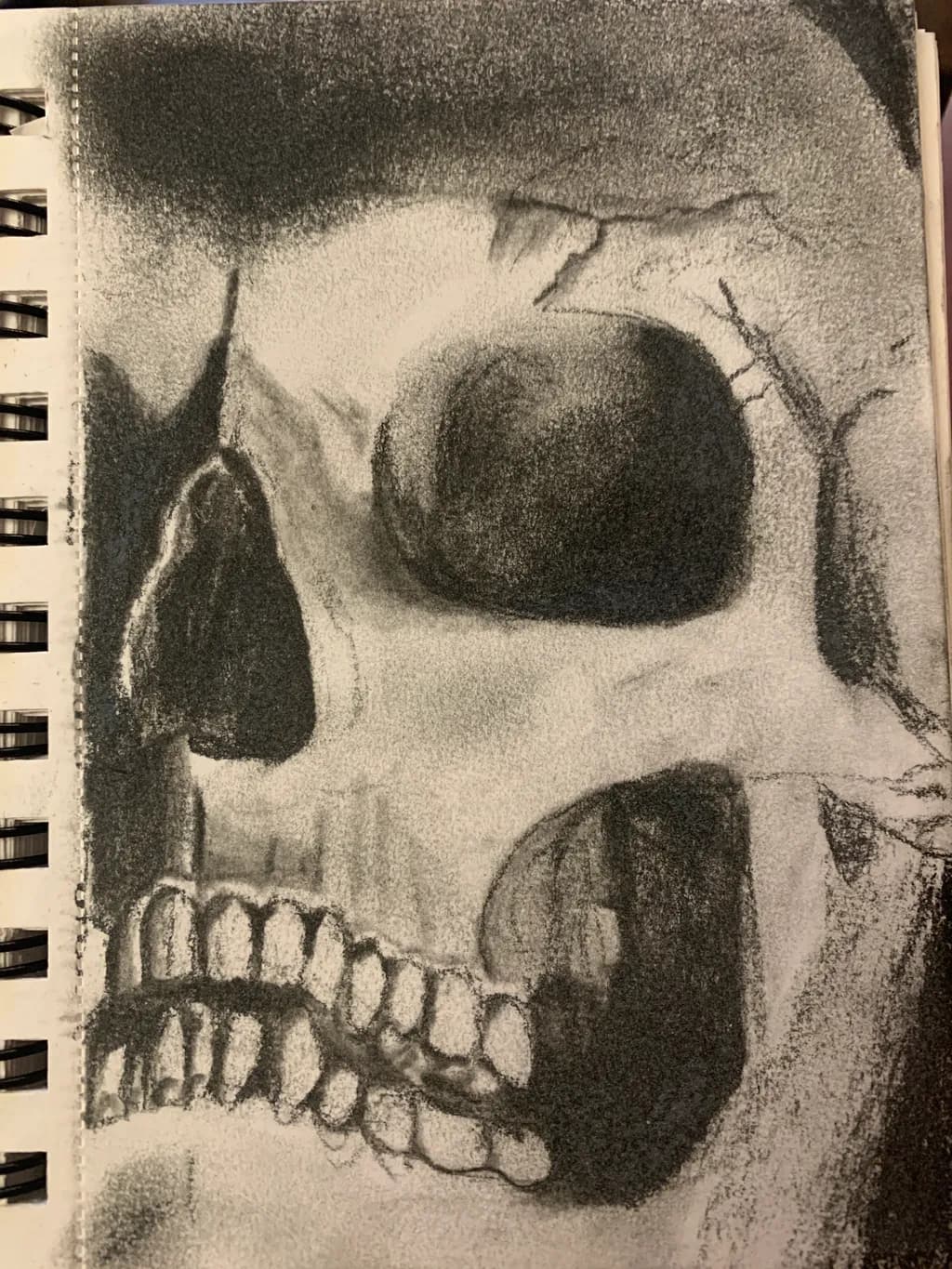 Fragmented Skull