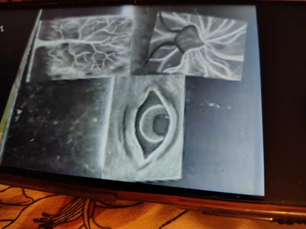 Vein and Orb Forms