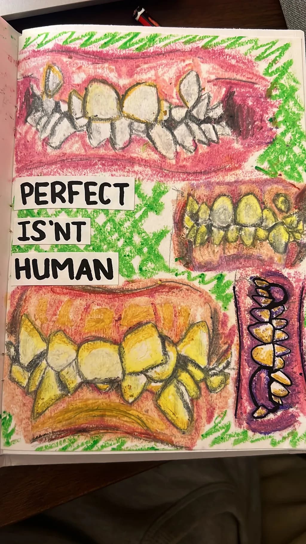 Imperfect Smiles