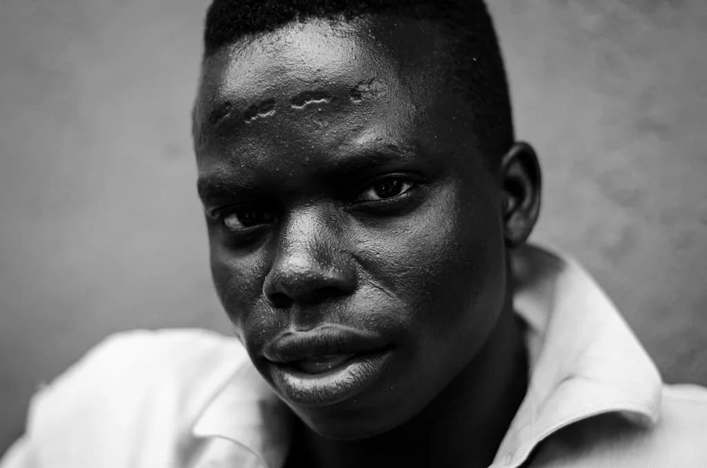 Scarred Portrait