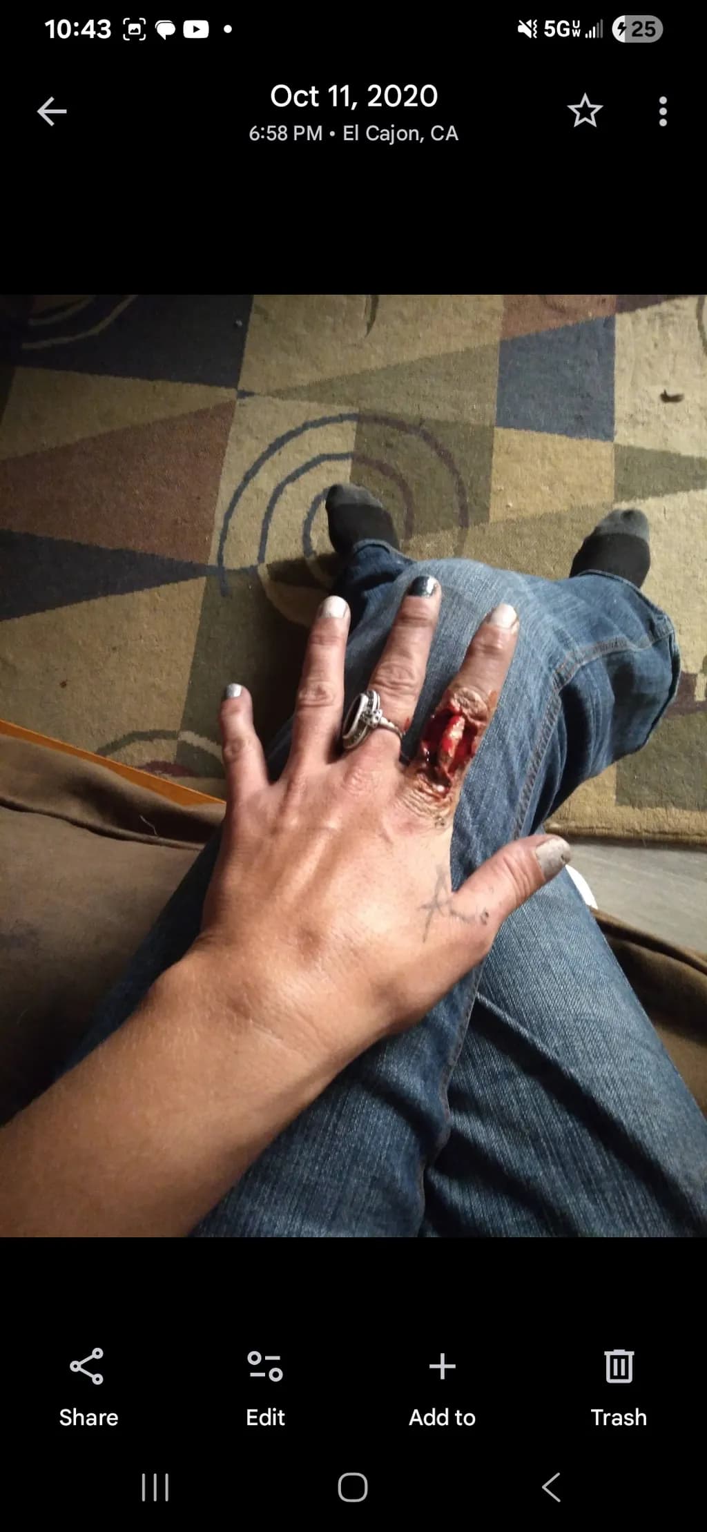 The Wound I Wear