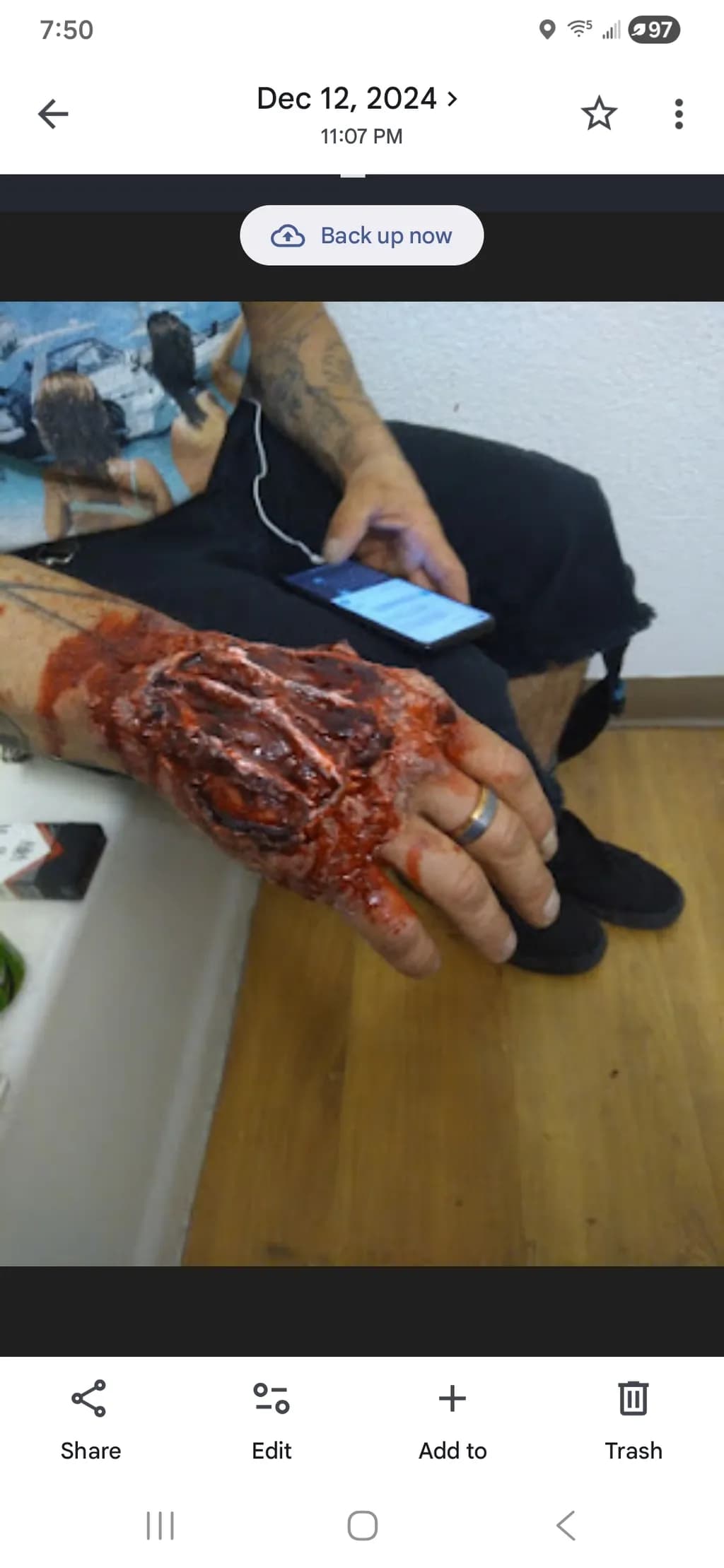 The Hand That Heals