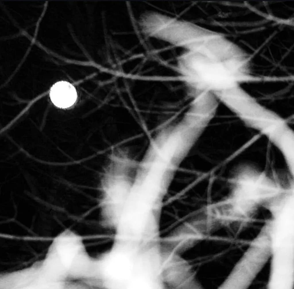 Moonlight Through Branches