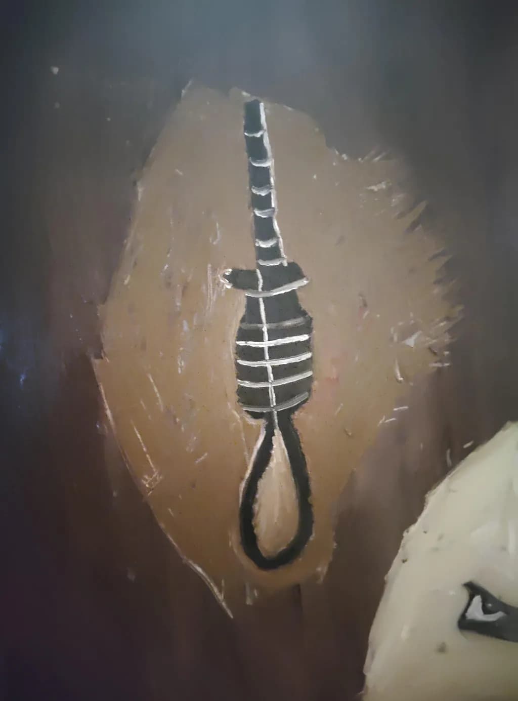 Depression